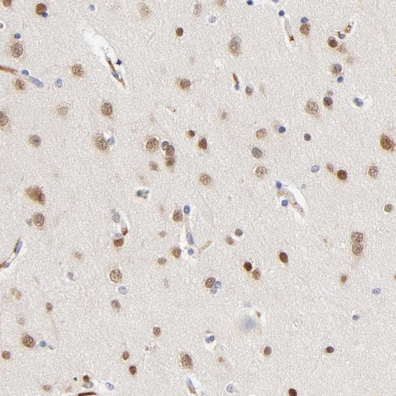 Anti-NOVA1 Antibody