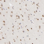 Anti-NOVA1 Antibody
