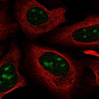 Immunofluorescent staining of human cell line U-2 OS shows localization to nucleoli.