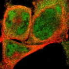 Immunofluorescent staining of human cell line A-431 shows localization to nucleoplasm & cytosol.