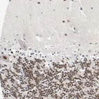 Immunohistochemical staining of human cerebellum shows moderate nuclear positivity, mainly in cells in granular layer.