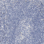 Anti-SALL2 Antibody