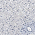 Immunohistochemical staining of human liver shows no positivity in hepatocytes as expected.