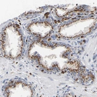 Immunohistochemical staining of human prostate shows strong granular cytoplasmic positivity in glandular cells.