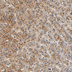 Anti-CAPN10 Antibody