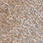 Immunohistochemical staining of human liver shows moderate granular cytoplasmic positivity in hepatocytes.