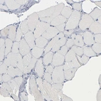 Immunohistochemical staining of human skeletal muscle shows no positivity in myocytes as expected.