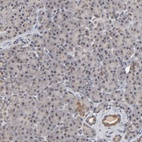 Anti-AUH Antibody