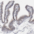 Immunohistochemical staining of human Fallopian tube shows weak to moderate nuclear positivity in glandular cells.