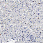 Anti-RUNX1 Antibody