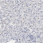 Immunohistochemical staining of human liver shows no positivity in hepatocytes as expected.