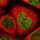 Immunofluorescent staining of human cell line A-431 shows localization to nucleoplasm & vesicles.