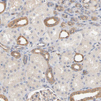 Immunohistochemical staining of human kidney shows moderate cytoplasmic positivity in cells in distal tubules.