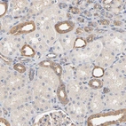 Immunohistochemical staining of human kidney shows moderate cytoplasmic positivity in cells in distal tubules.