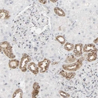 Immunohistochemical staining of human kidney shows moderate cytoplasmic positivity in cells in distal tubules.
