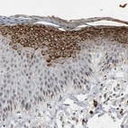 Immunohistochemical staining of human skin shows strong cytoplasmic positivity in squamous epithelial cells.