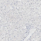 Immunohistochemical staining of human liver shows no positivity in hepatocytes as expected.