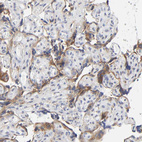 Anti-LRP1 Antibody