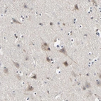 Immunohistochemical staining of human cerebral cortex shows weak cytoplasmic positivity in neurons.