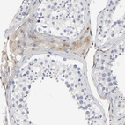 Immunohistochemical staining of human testis shows weak cytoplasmic positivity in Leydig cells.