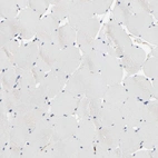 Immunohistochemical staining of human skeletal muscle shows no positivity in myocytes as expected.