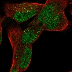 Immunofluorescent staining of human cell line RH-30 shows localization to nucleoplasm & vesicles.