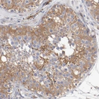 Immunohistochemical staining of human Testis shows moderate cytoplasmic positivity in cells in seminiferous ducts.
