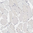 Immunohistochemical staining of human Skeletal muscle shows very weak cytoplasmic positivity in myocytes.