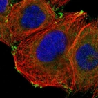 Immunofluorescent staining of human cell line A-431 shows localization to cytosol & focal adhesion sites.