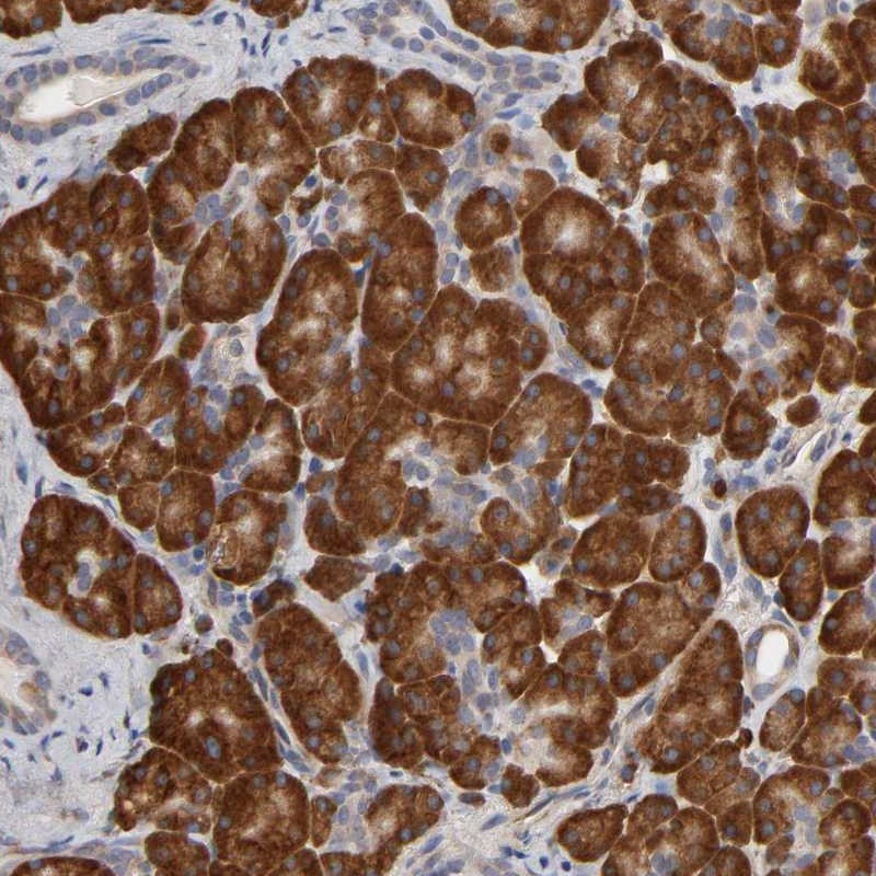 Anti-HDLBP Antibody