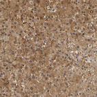 Immunohistochemical staining of human liver shows moderate cytoplasmic positivity in hepatocytes.
