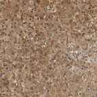 Immunohistochemical staining of human liver shows moderate cytoplasmic positivity in hepatocytes.