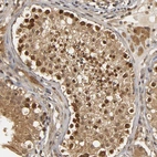 Immunohistochemical staining of human testis shows moderate nuclear and cytoplasmic positivity in cells in seminiferous ducts.