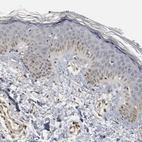 Immunohistochemical staining of human skin shows no positivity in squamous epithelial cells as expected.
