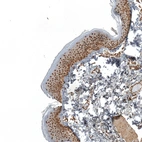 Immunohistochemical staining of human skin shows strong nuclear positivity in squamous epithelial cells.