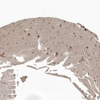 Immunohistochemical staining of human cerebral cortex shows strong nuclear positivity in neurons.