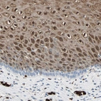 Immunohistochemical staining of human esophagus shows moderate to strong cytoplasmic and nuclear positivity in squamous epithelial cells.