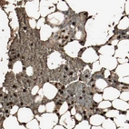 Immunohistochemical staining of human bone marrow shows strong cytoplasmic positivity in a subset of hematopoietic cells.