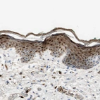 Immunohistochemical staining of human skin shows moderate to strong cytoplasmic and nuclear positivity in squamous epithelial cells.