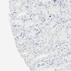 Anti-S100A9 Antibody