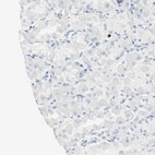 Immunohistochemical staining of human stomach shows no positivity in glandular cells as expected.