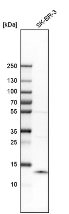 Western blot analysis in human cell line SK-BR-3.