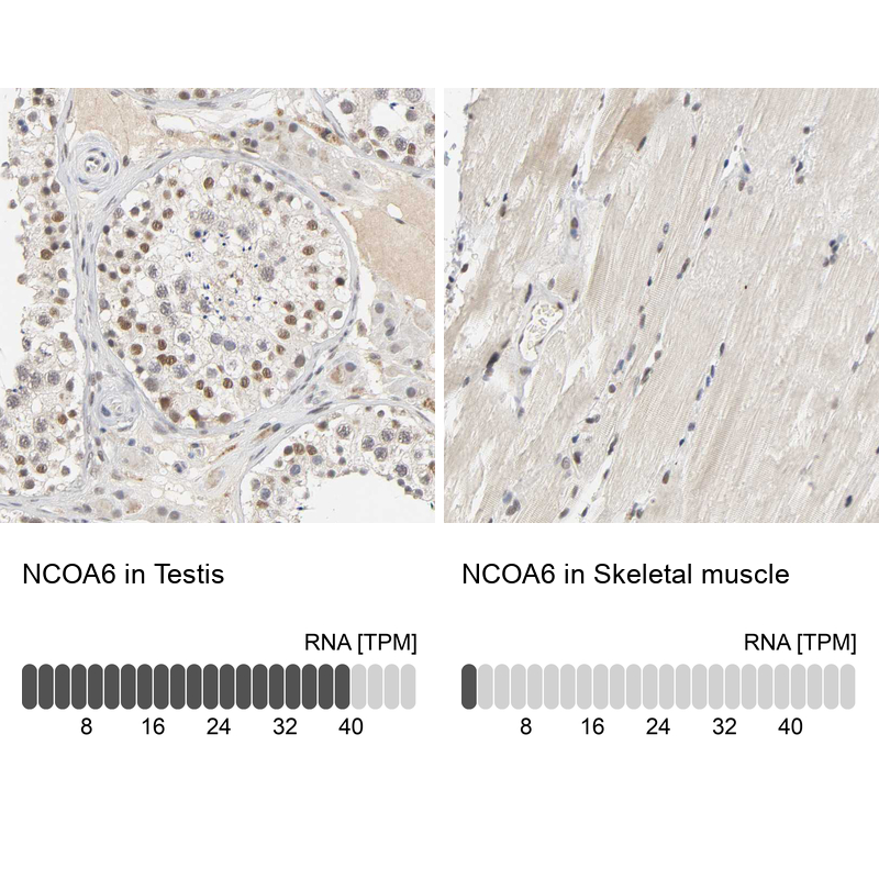 Anti-NCOA6 Antibody