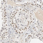 Immunohistochemical staining of human testis shows moderate to strong nuclear positivity in cells in seminiferous ducts.