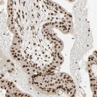 Immunohistochemical staining of human placenta shows moderate to strong nuclear positivity in trophoblastic cells.