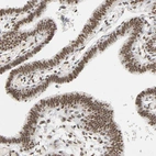 Immunohistochemical staining of human fallopian tube shows moderate to strong nuclear positivity in glandular cells.