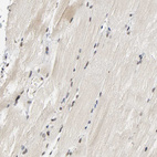 Anti-NCOA6 Antibody