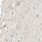 Immunohistochemical staining of human skeletal muscle shows weak nuclear positivity in myocytes.