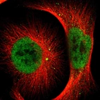 Immunofluorescent staining of human cell line U-251 MG shows localization to nucleoplasm & vesicles.
