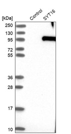 Western blot analysis in control (vector only transfected HEK293T lysate) and SYT16 over-expression lysate (Co-expressed with a C-terminal myc-DDK tag (~3.1 kDa) in mammalian HEK293T cells, LY410443).